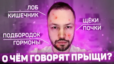 Карта прыщей. Что означает расположение прыщей на лице? - YouTube