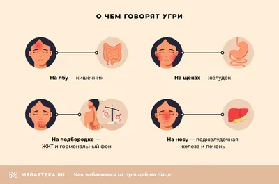 Прыщи на лице: причины появления, лечение и профилактика