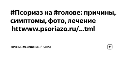 Псориаз волосистой части головы: средства и методы лечения и ухода