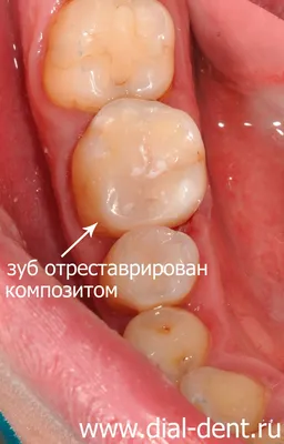 💊 Лечение пульпита в САО Москвы м. Аэропорт