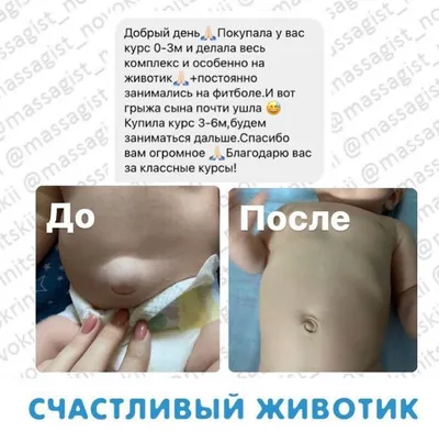 Девочки, это пупочная грыжа или я загоняюсь? — 11 ответов | форум Babyblog