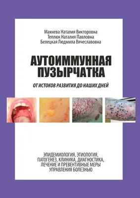 Отзыв о Комнатный цветок \"Пузырчатка\" | Экзотичное, но при этом очень  неприхотливое растение