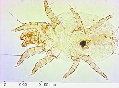 Пылевые клещи: подробное описание и факты