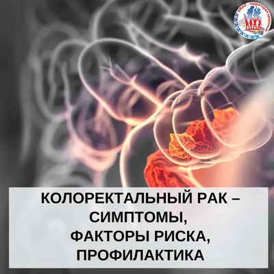 Рак желудка: причины, симптомы и лечение всех видов заболеваний в ФНКЦ ФМБА