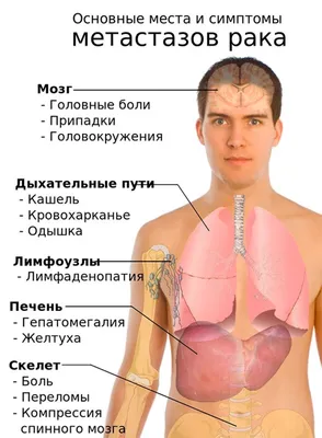 Каким бывает рак сердца — смертельная болезнь, о которой почти никто не  говорит