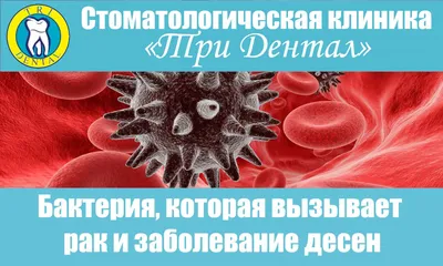 Гингивит - причины появления, симптомы заболевания, диагностика и способы  лечения