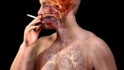 Курение и рак гортани: так ли это страшно? | ЛОР КЛИНИКА ЗАЙЦЕВА | Дзен