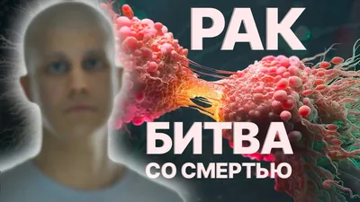 Почему возникает рак гортани? | 1000 и 1 вопрос об онкологии | Дзен