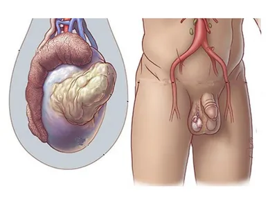 Рак яичка у мужчин: симптомы, причины и лечение - клиника урологии в Москве