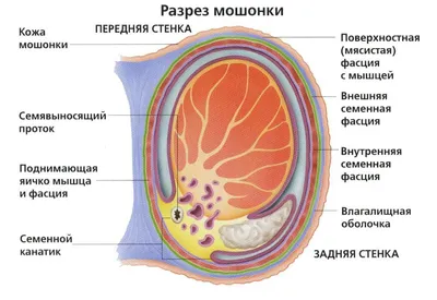 Лечение рака яичек