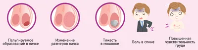 Симптомы и прогнозы жизни при раке яичек 3 стадии