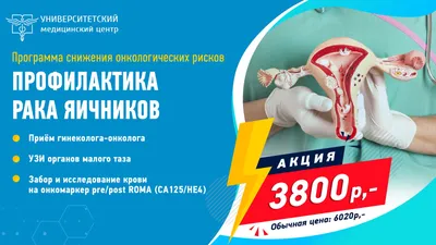 Современные протоколы 2021 лечения рака яичника за рубежом - Clinics on Call