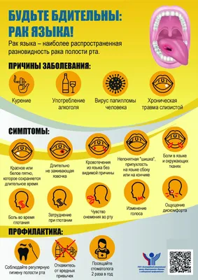 Рак языка - причины появления, симптомы заболевания, диагностика и способы  лечения