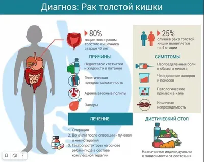 КОЛОРЕКТАЛЬНЫЙ РАК. Как его избежать?!