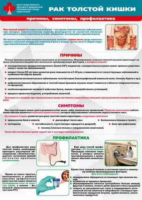 7-13 ноября неделя профилактики рака толстой кишки (популяризация  цельнозерновых продуктов) | РКБ г. Реутов