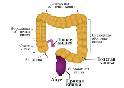 РАК ОБОДОЧНОЙ (ТОЛСТОЙ) КИШКИ | MED Expert