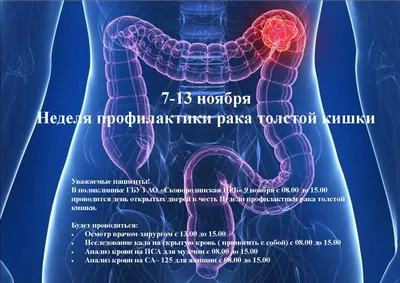 Колоректальный (толстокишечный) рак | Первый клинический медицинский центр