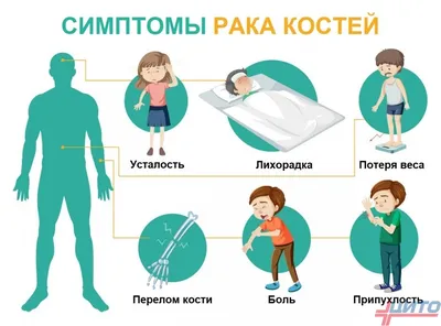 Рак костей, мягких тканей, суставов - лечение • Русский Доктор