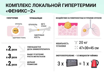 Саркома кости, остеосаркома: симптомы и признаки рака костей, как  проявляется, фото | Клиники «Евроонко»