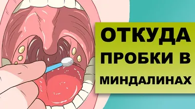 У гитариста Oasis Пола Артурса диагностировали рак миндалин