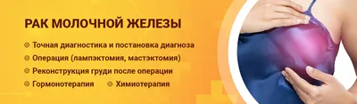 Рак молочной железы: симптомы, диагностика и лечение у мужчин