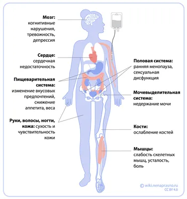 Березниковские врачи-онкологи внедрили технологию лечения рака молочной  железы с сохранением формы после удаления органа - НЕДЕЛЯ.RU