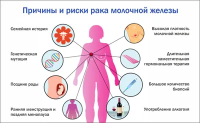 Рак молочной железы - Областное бюджетное учреждение здравоохранения  \"Городская клиническая больница №4\"