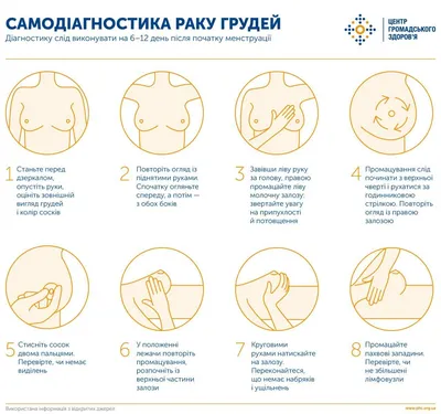 Реальные признаки рака молочной железы