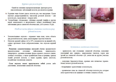 Иммунная тромбоцитопения (ИТП) - Гематология и онкология - Справочник MSD  Профессиональная версия