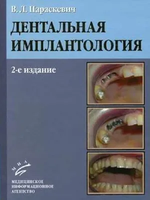 Молочница во рту (кандидоз) – у детей и взрослых, симптомы, причины, лечение