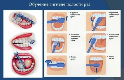 Пластика десны или гингивопластика в Damas Medical Center