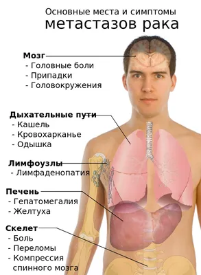 Он сжигает изнутри»: всё, что вы боялись спросить о раке / Новости общества  Красноярска и Красноярского края / Newslab.Ru