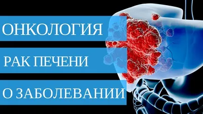 Рак печени иллюстрация вектора. иллюстрации насчитывающей клетки - 29364287