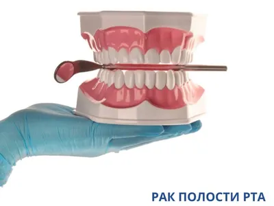 Рак полости рта! Что скрывают стоматологи? ч.1 | Обычный стоматолог | Дзен