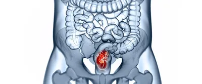 Рак прямой кишки – диагностика, симптомы, лечение в ФНКЦ ФМБА России