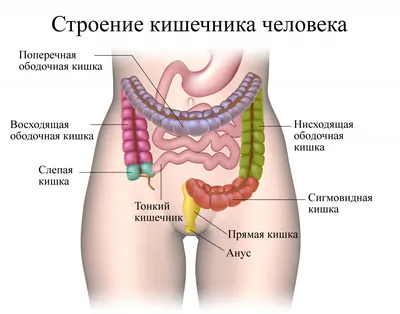 Рак ободочной кишки