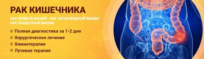 Рак толстой кишки: симптомы, диагностика, лечение, стадии и профилактика  онкологии