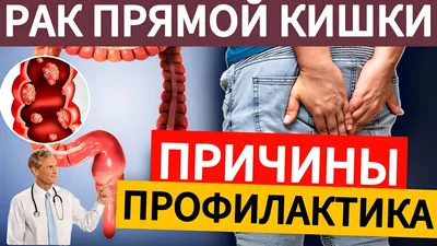 Рак кишечника 4 стадия. Информация для пациентов