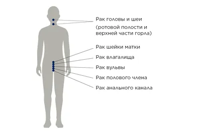 ВПЧ: как передается, как не заразить партнера папилломавирусом