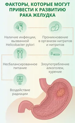 Рак желудка: причины, первые признаки, стадии, как снизить риск появления  онкологии желудка?