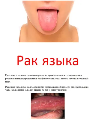 Рак желудка - симптомы болезни и как диагностировать | РБК Украина
