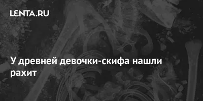 Рахит у детей - лечение дефицита витамина D в Мытищах