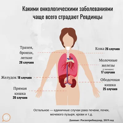 Что такое липома, чем она опасна и как лечится? : статьи клиники Оксфорд  Медикал Киев