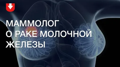 Рак молочной железы 2 стадия: симптомы, диагностика, лечение рака молочной  железы 2й стадии - Онкоцентр «Добрый прогноз»