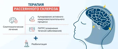 Рассеянный склероз - симптомы, лечение и причины появления, Московский  Центр РС