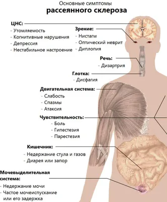 Подвижность и рассеянный склероз - Израильская ассоциация рассеянного  склероза