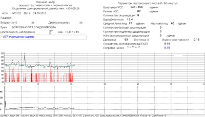 Образцы КТГ