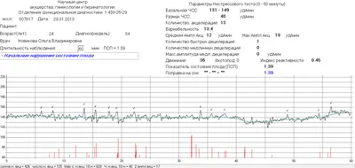 Расшифровка ктг плода на сроке 32.4 недели - Вопрос гинекологу - 03 Онлайн