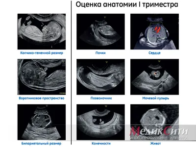 КТГ (Кардиотокография) плода — цены в Санкт-Петербурге | ЦПС Медика