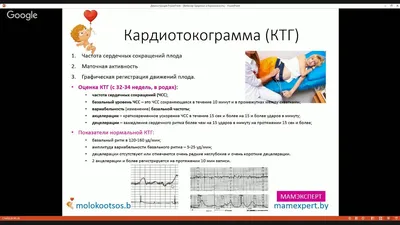 Расшифровка КТГ плода: результаты, баллы